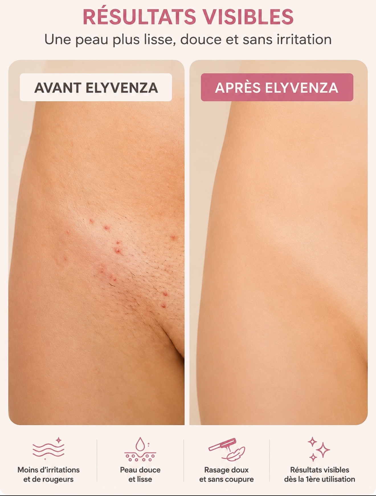 Elyvenza – Rasoir Douceur 2-en-1